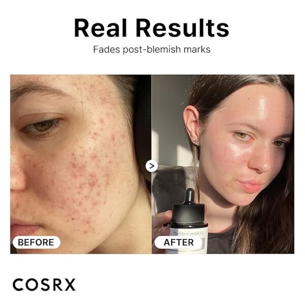 Best deal 40% discount || Niacinamide Face Serum - Image 2